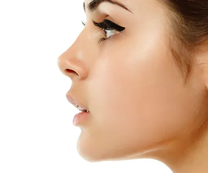 Rhinoplasty Trends Are Changing—Here’s What Plastic Surgeons Want You to Know